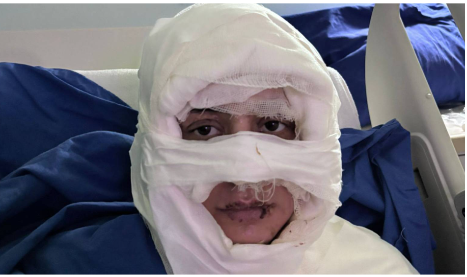 Kadıköy'de bir kadın, üzerine yanıcı madde dökülerek ateşe verildi